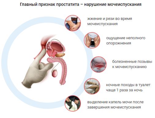 Купить лечение аденомы простаты народными средствами russianhunt магазин